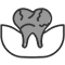 Occlusal Splint