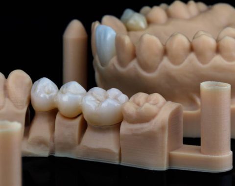 dental crowns